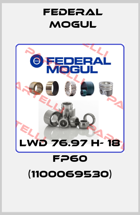 LWD 76.97 H- 18 FP60 (1100069530) Federal Mogul